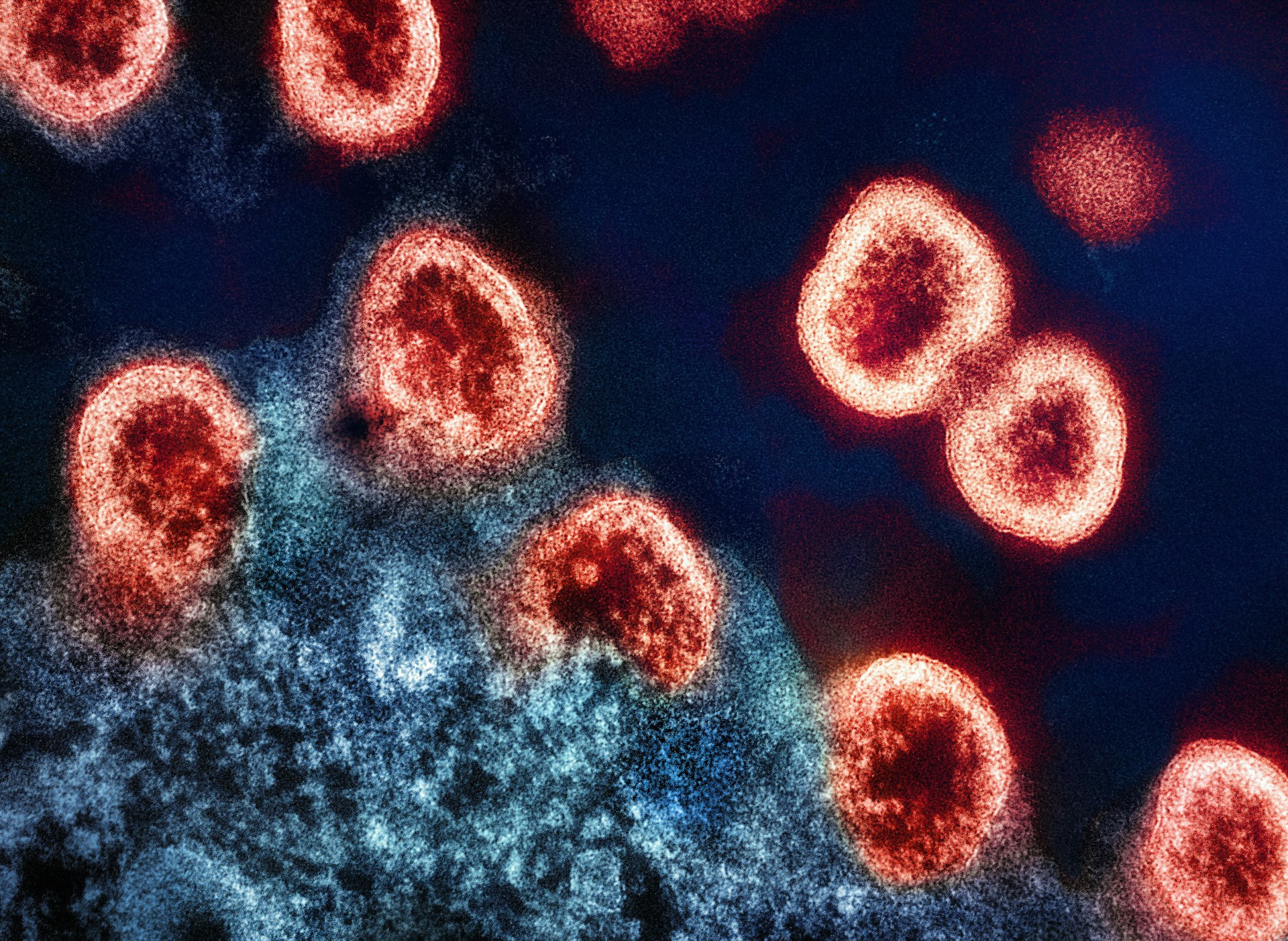 Bloodborne Pathogens